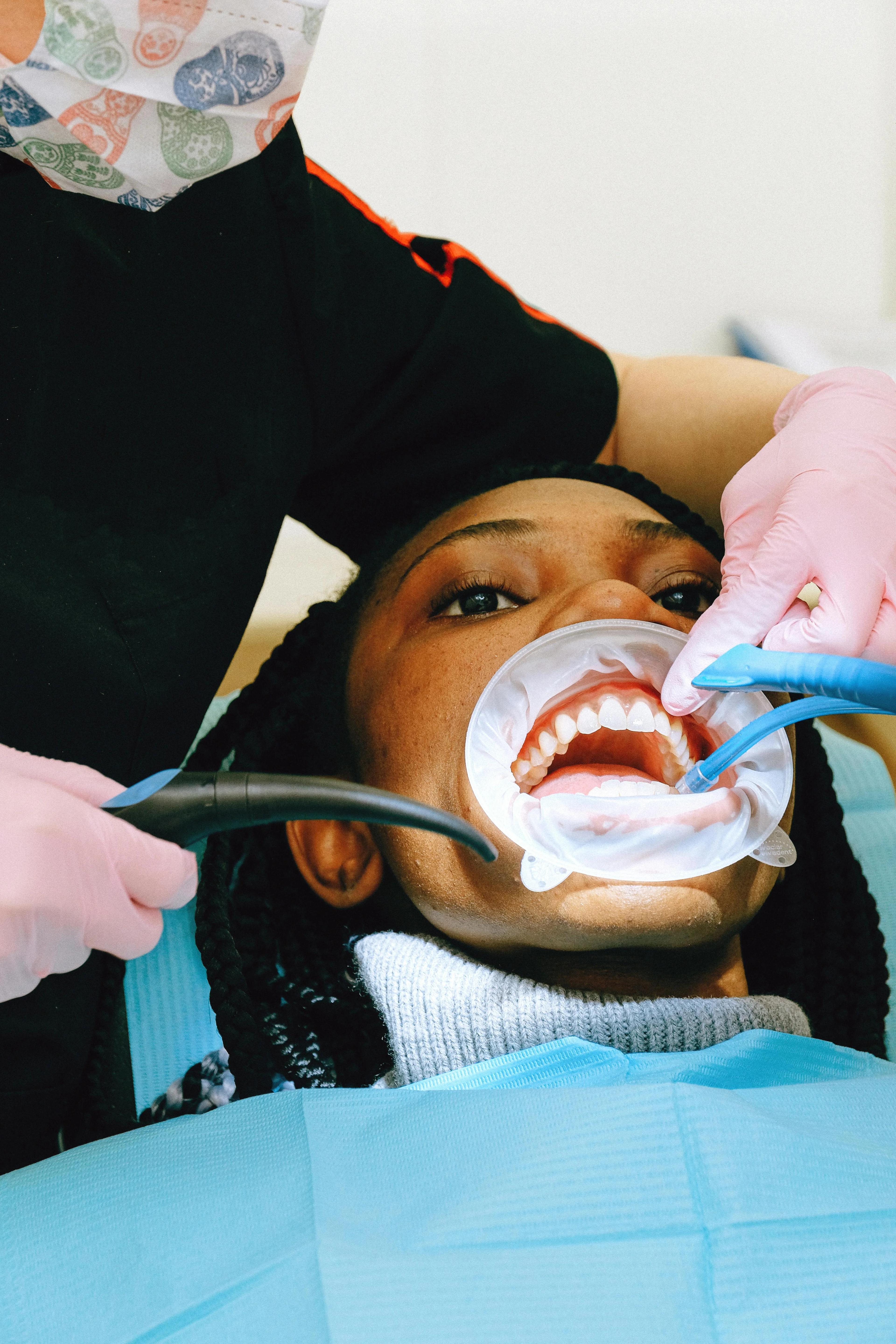 Teeth whitening shade change being shown